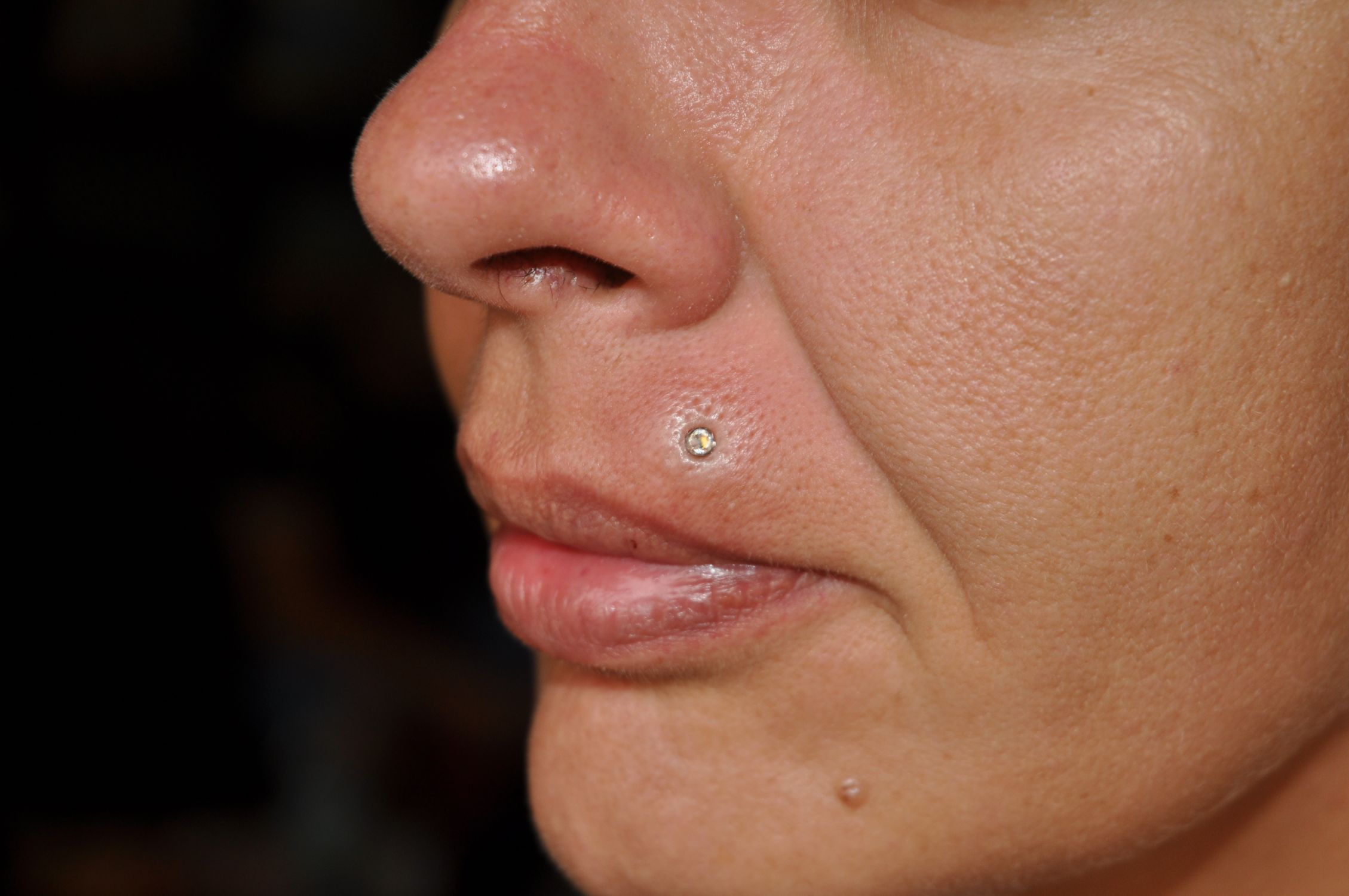 Microdermal piercing