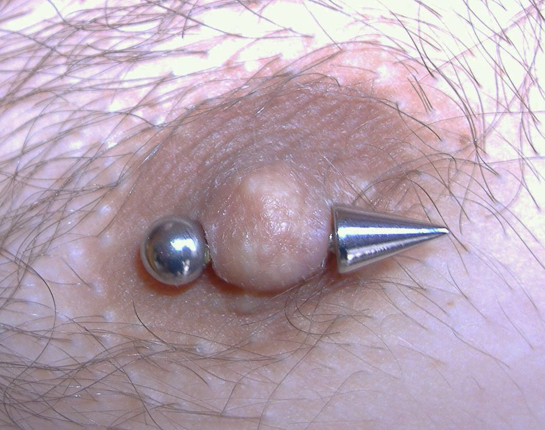 Intim piercing, Mell piercing